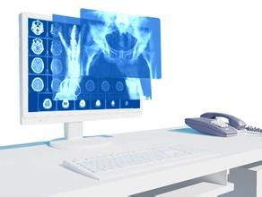 烟台浩园软件PACS系统 引领智慧医疗与健康养老新未来